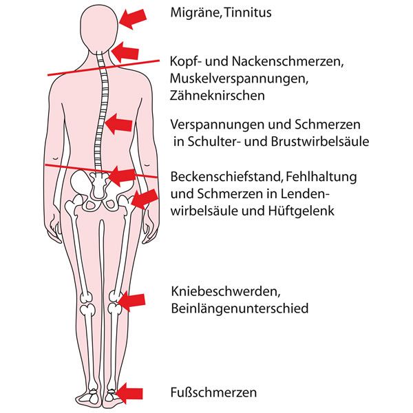 CMD: Kiefer-, Kopf-, Rückenschmerzen in Moers?